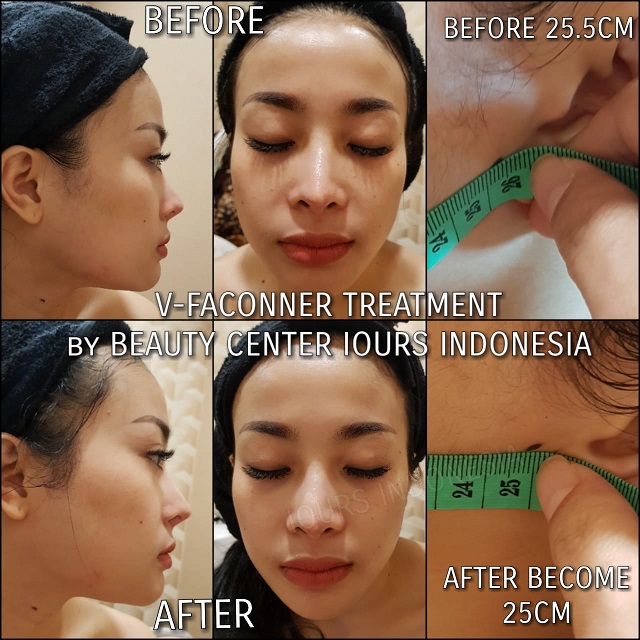 Beauty Treatment